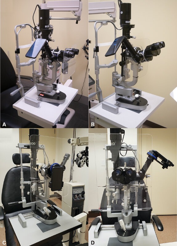 Portable Digital Slit Lamp